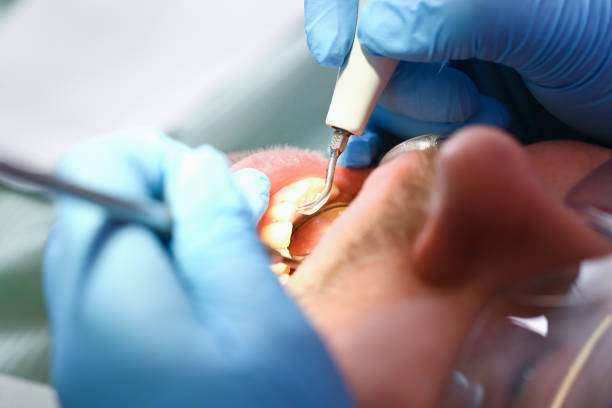 Best Emergency Cosmetic Dentistry (e.g., broken veneers) in Prudhoe Bay, AK